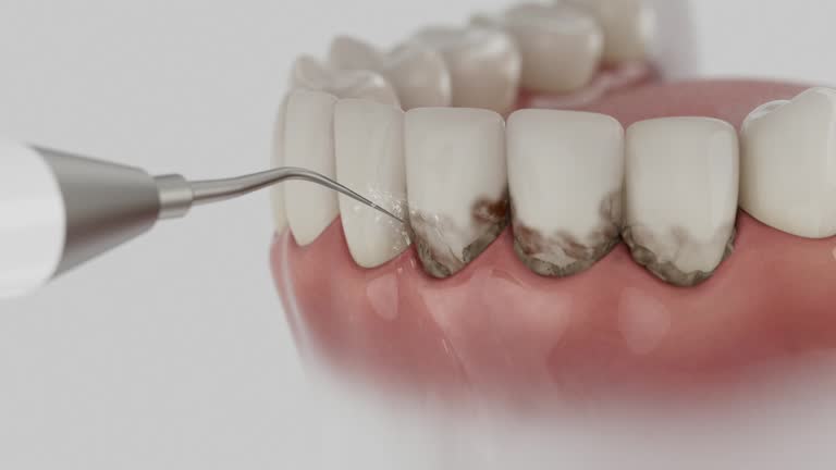 Reliable Dental Implants contractor in New Castle, CO by Smile Center Dentistry